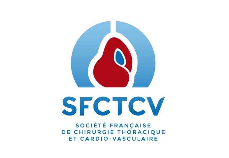 SFCTCV