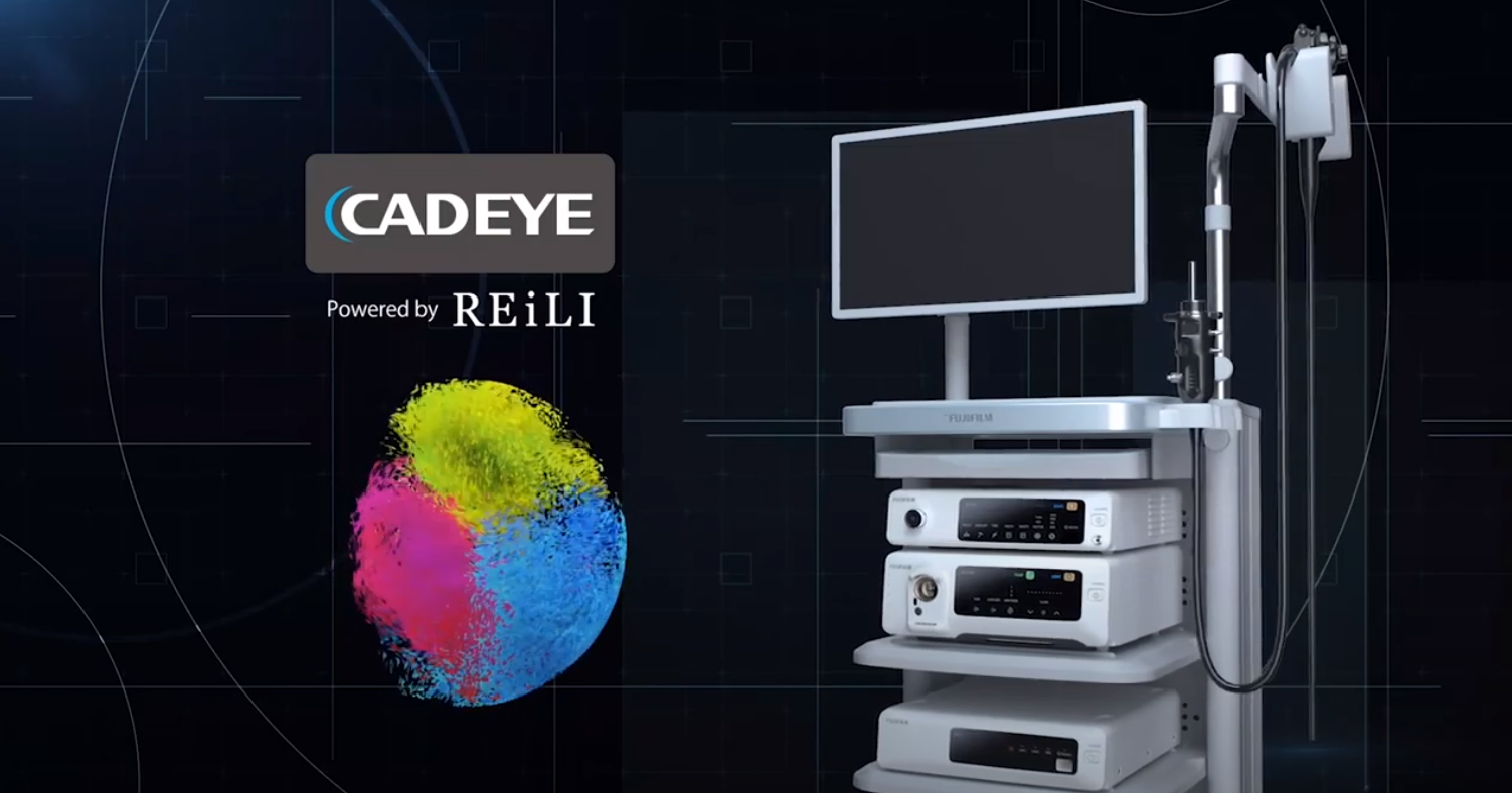 CADEYE