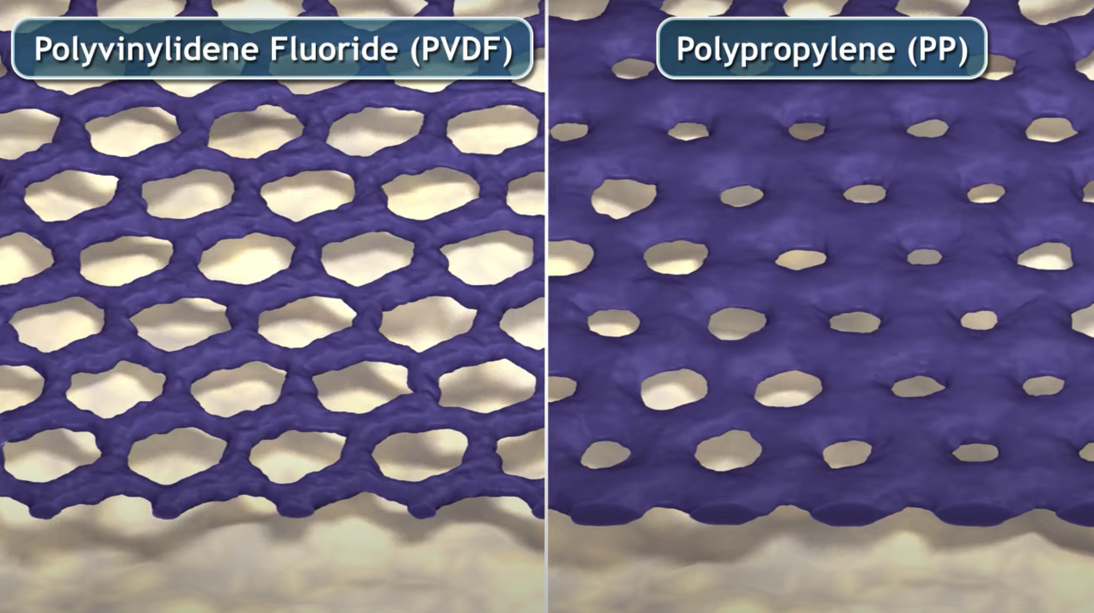 Foreign Body Reaction – Comparison of PVDF and PP