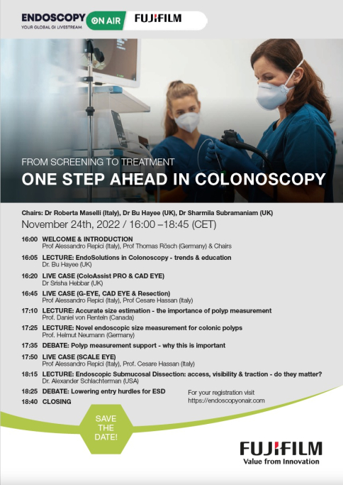 Webinar: One Step ahead in Colonoscopy