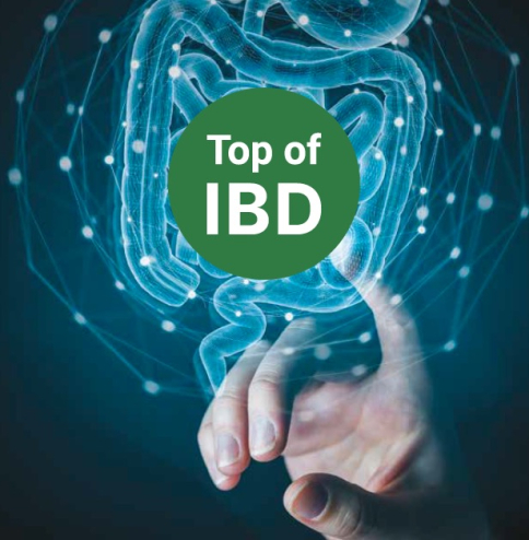 Top of IBD