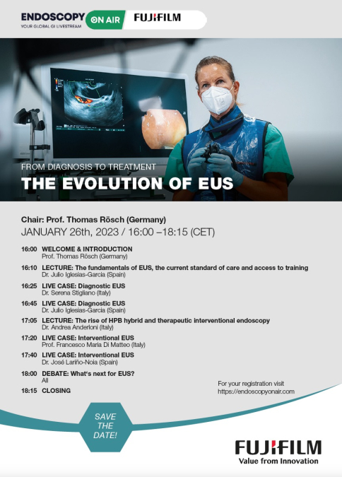 Endoscopy on Air Fujifilm