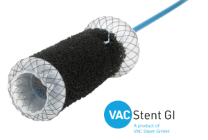 The VacStent GI™ 