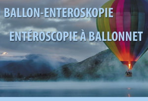 Zubehör Ballon-Enteroskopie