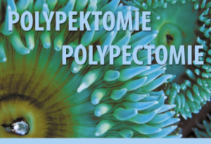 Polypektomie