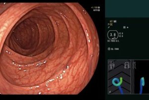 Endoscope Visualizer EV-3D
