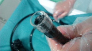 Distal Caps