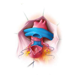 peterssurgical