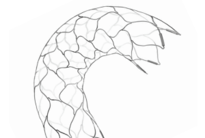 Cerenovus Enterprise® 2