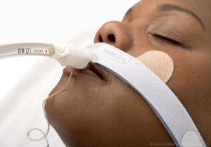 endotracheal-tube-holder