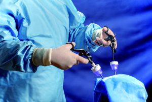 Laparoscopic Instruments