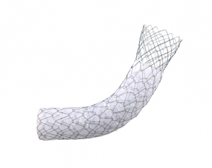 Niti-S™ COMVI™ Flare Pyloric/duodenal Stent - TaeWoong 