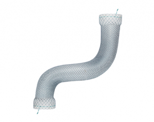 Niti-S™ MEGA™ Esophageal Stent - TaeWoong