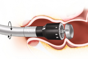 Circular staplers illustration