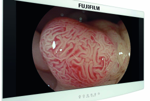 Fujifilm Monitors