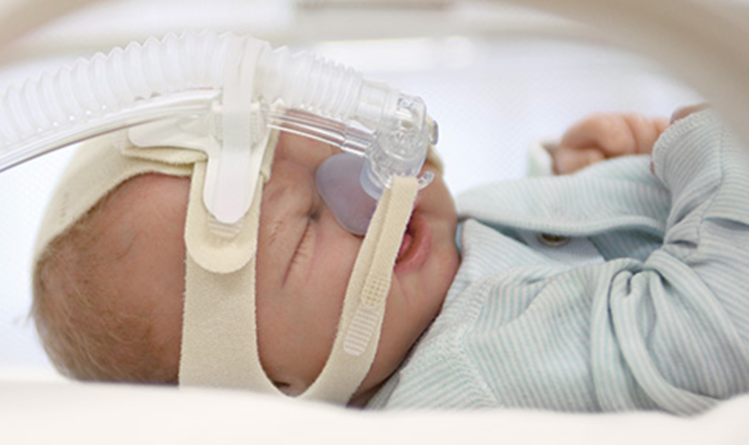 Почему новорожденные дышат чаще. Сипап аппарат для новорожденных недоношенных детей. Дыхание у недоношенных детей сипап. Апноэ у недоношенных новорожденных.