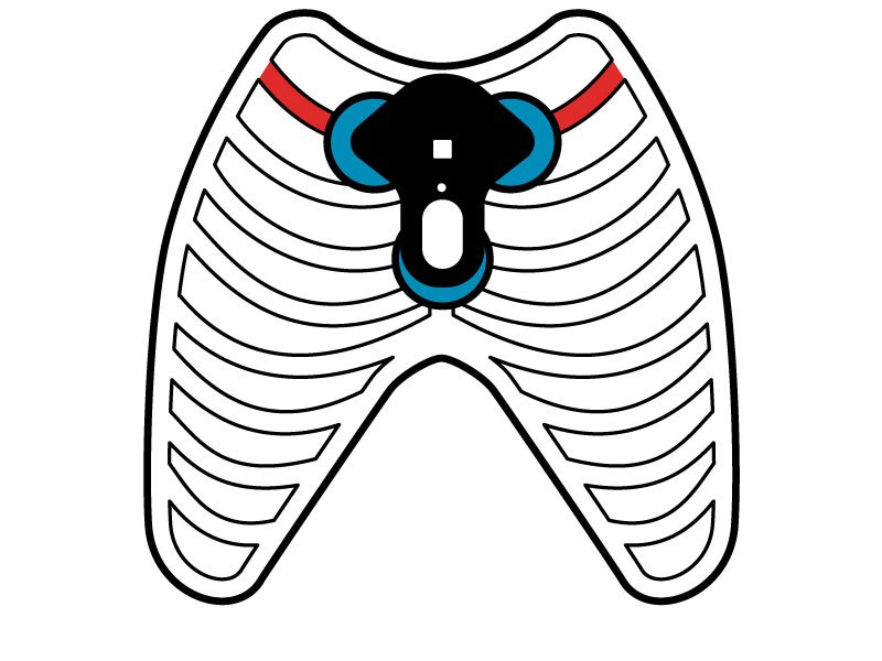 CardioMem® CM 100 XT