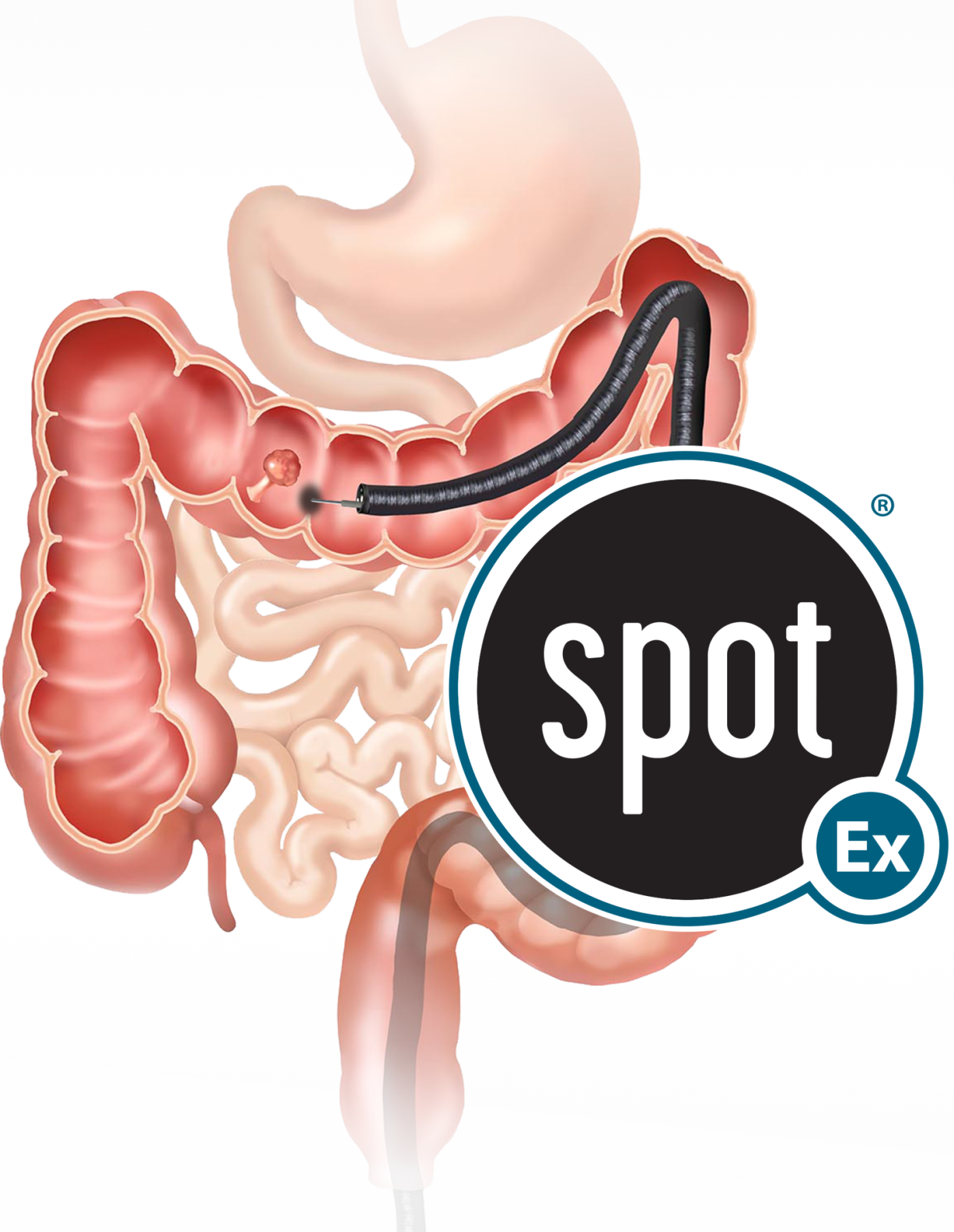 Spot ex - 3