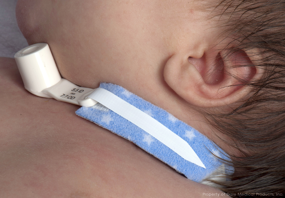 Tracheotomie tubehouder - Baby