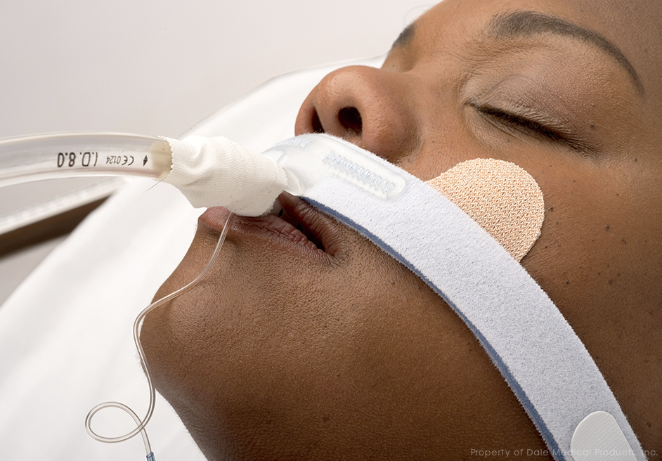 Endotracheale tubehouder