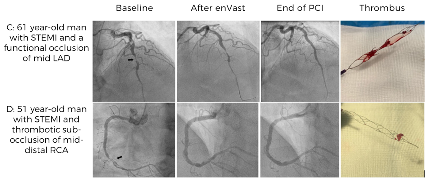 enVast Vesalio