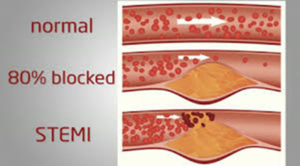 enVast Vesalio