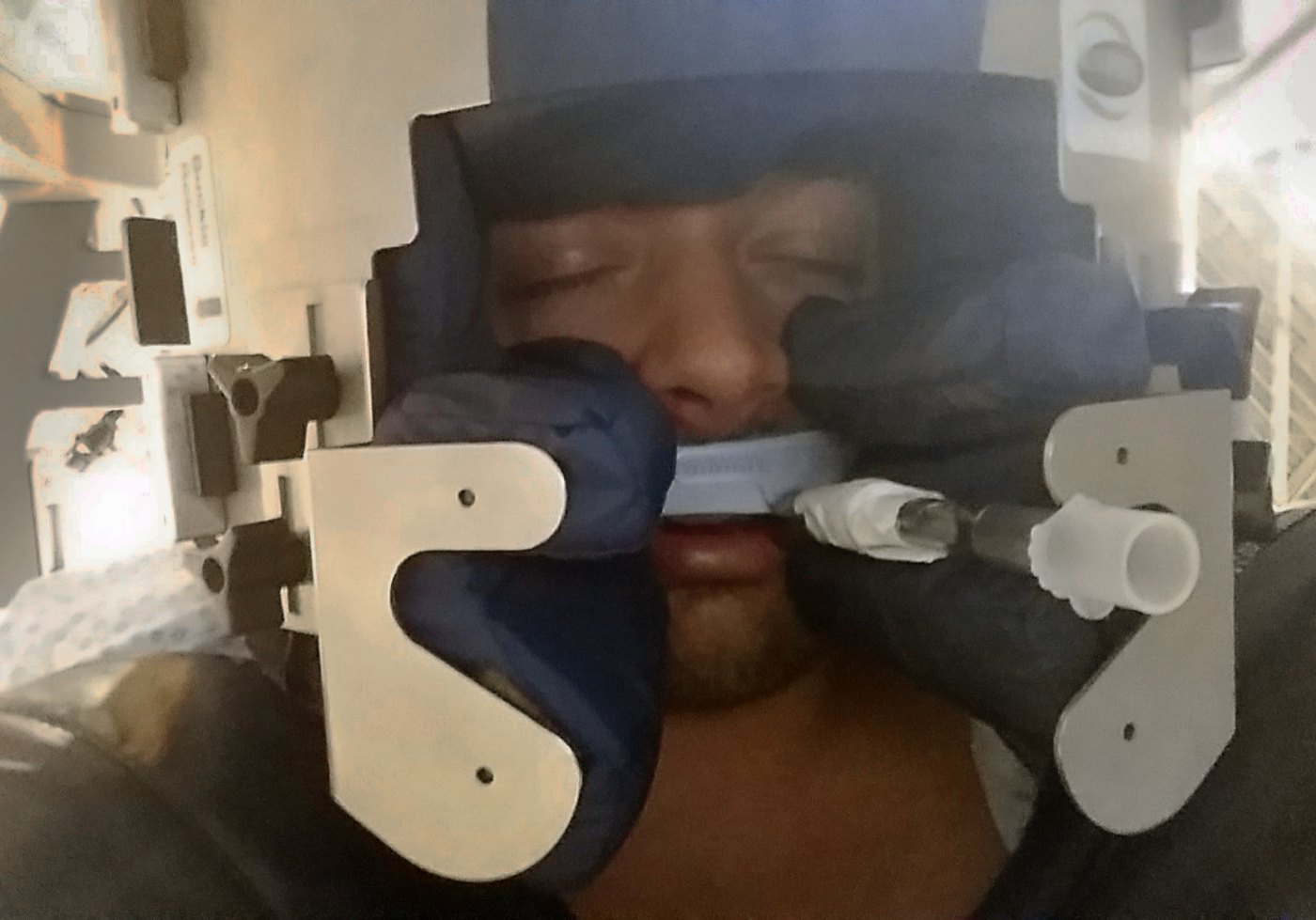 Endotracheale tubehouder 2