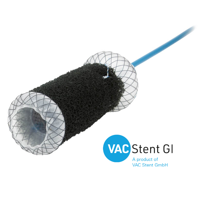 Esophageal Stent VacStent GI™