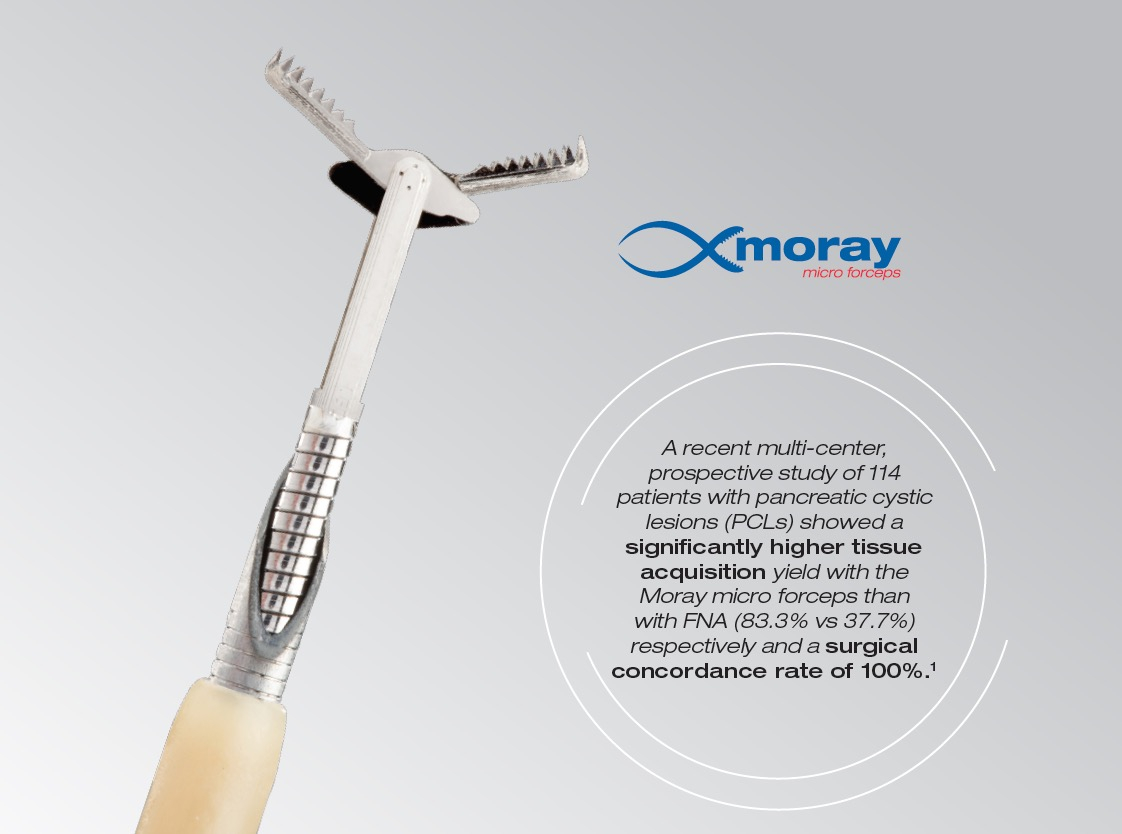 Moray® Micro Forceps - STERIS 2