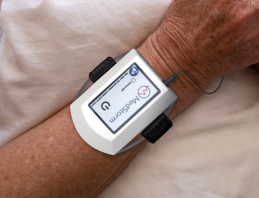 PAM Sensor