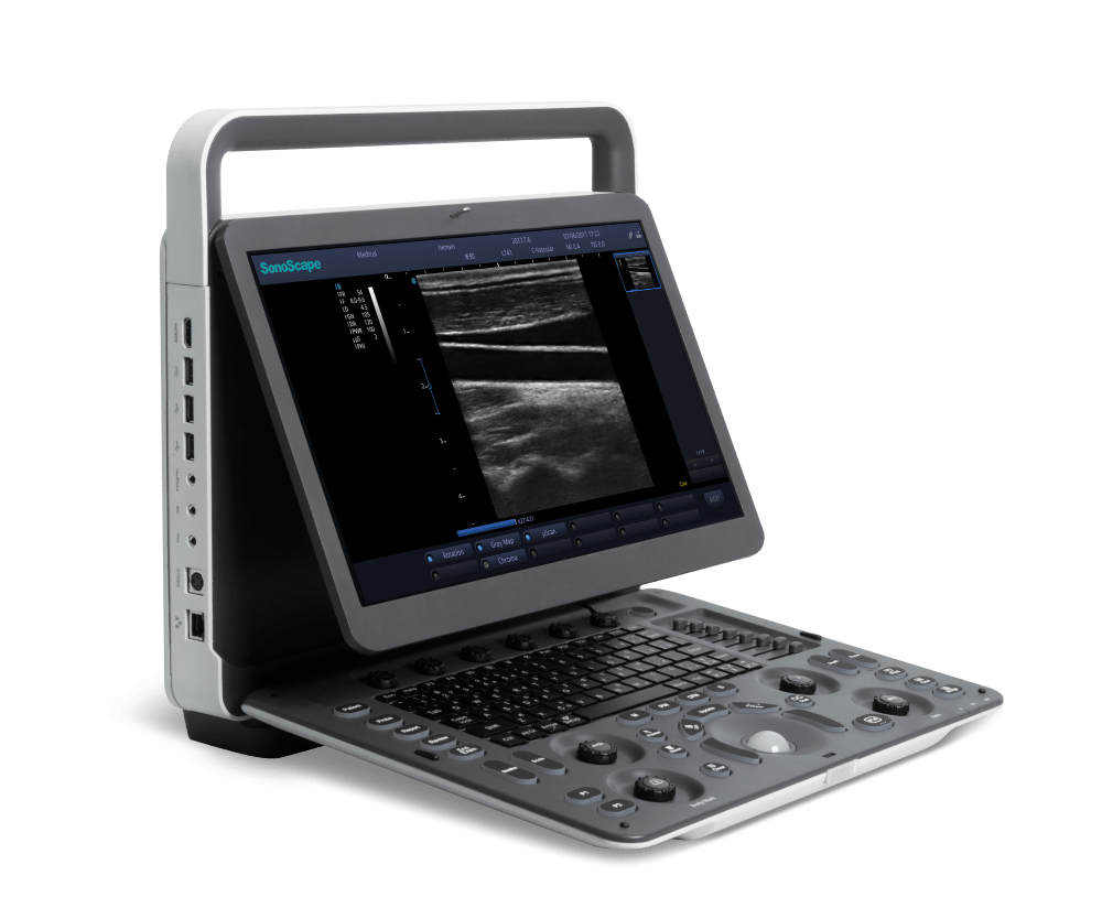 E2 Ultrasound system 3
