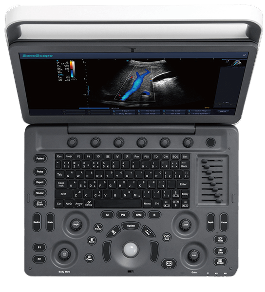 E2 Ultrasound system 1
