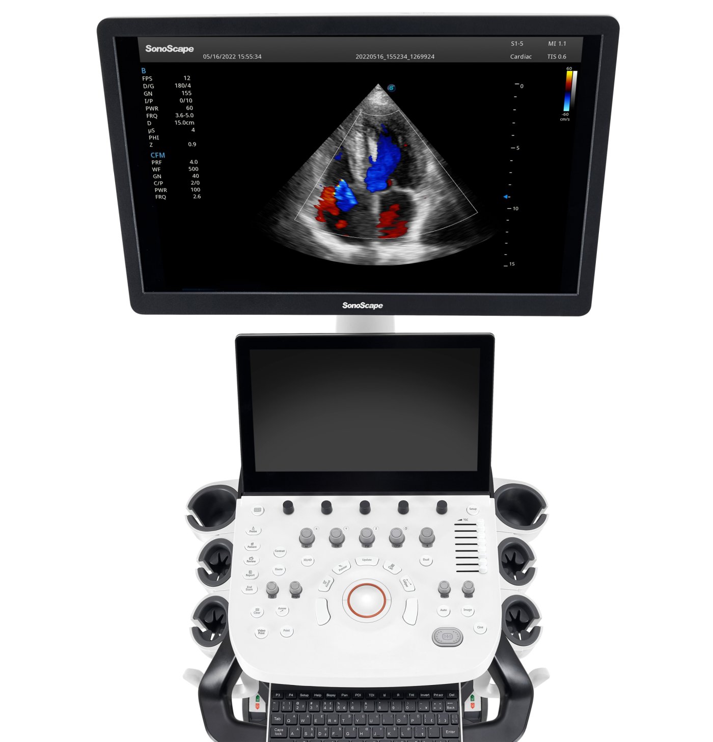 P25 Elite Ultrasound system SonoScape Duomed 3