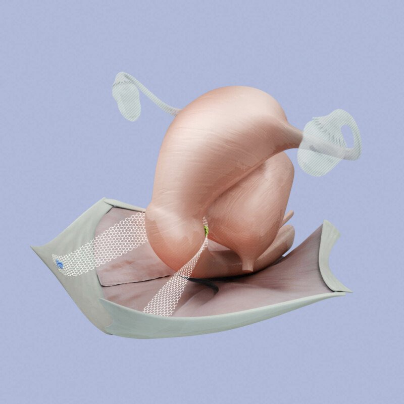 BSC Mesh