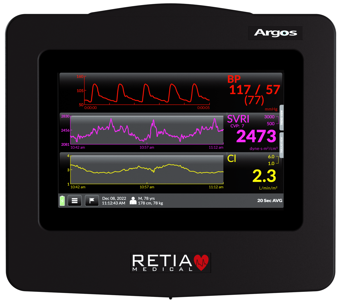 Argos monitor front
