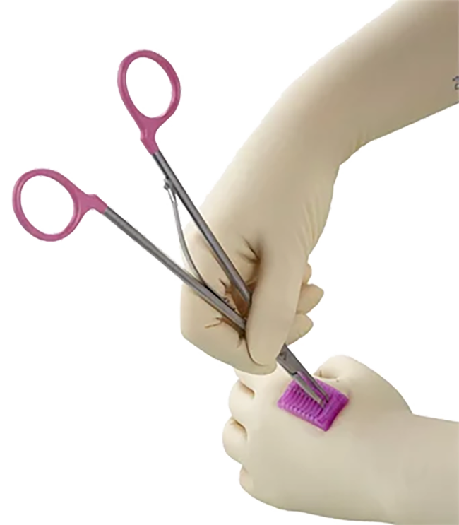 Vitalitec clips Péters Surgical