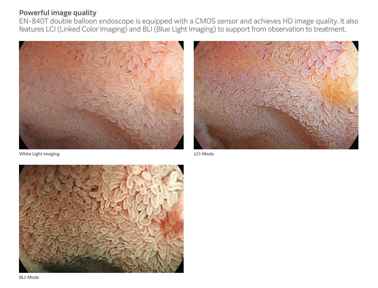 EN-840 T Double Balloon Enteroscope Therapeutic