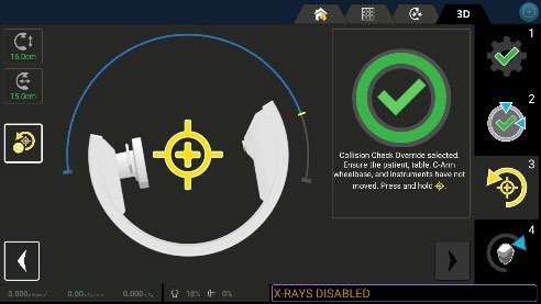 OEC 3D Lung Suite V3