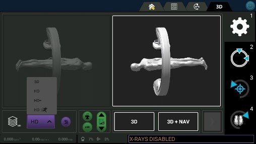OEC 3D Lung Suite V2