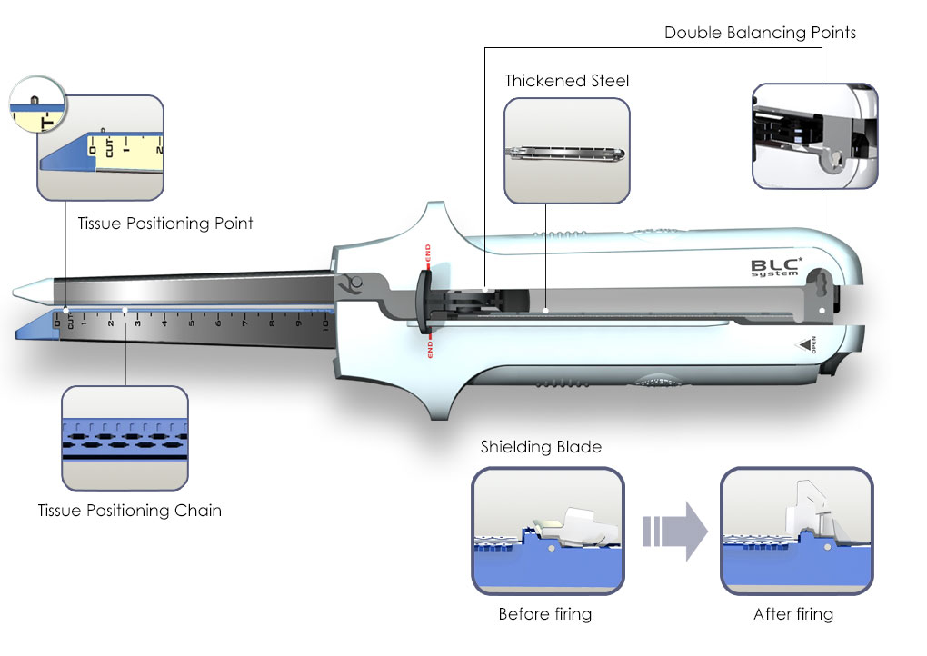 Linear Cutter and Reloads (LC&LCC) - Touchstone 2