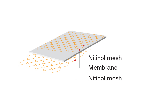 Niti-S™ COMVI™ Flare Pyloric/duodenal Stent - TaeWoong 2