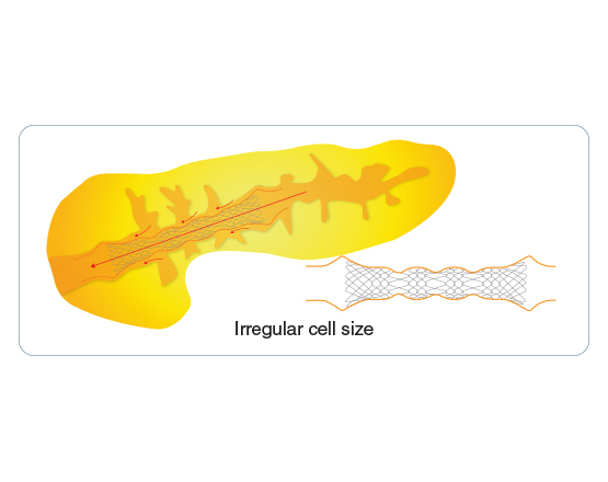 Niti-S™ BUMPY™ Biliary Stent - TaeWoong 3