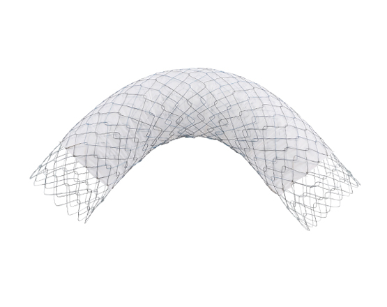 Niti-S™ COMVI™ Pyloric/duodenal Stent - TaeWoong 