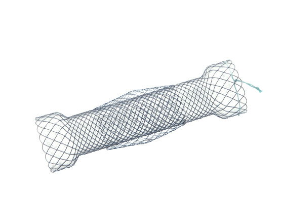Niti-S™ DOUBLE™ Esophageal Stent - TaeWoong 