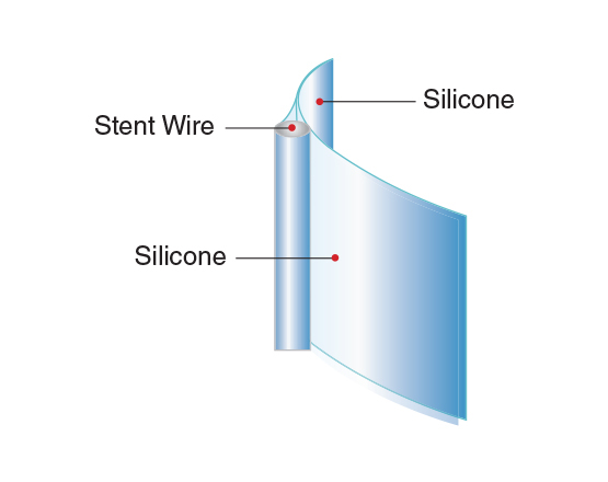 Niti-S™ S Biliary Stent (Covered) - Taewoong 3