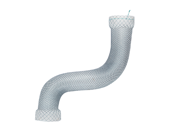Niti-S™ MEGA™ Esophageal Stent - TaeWoong -1