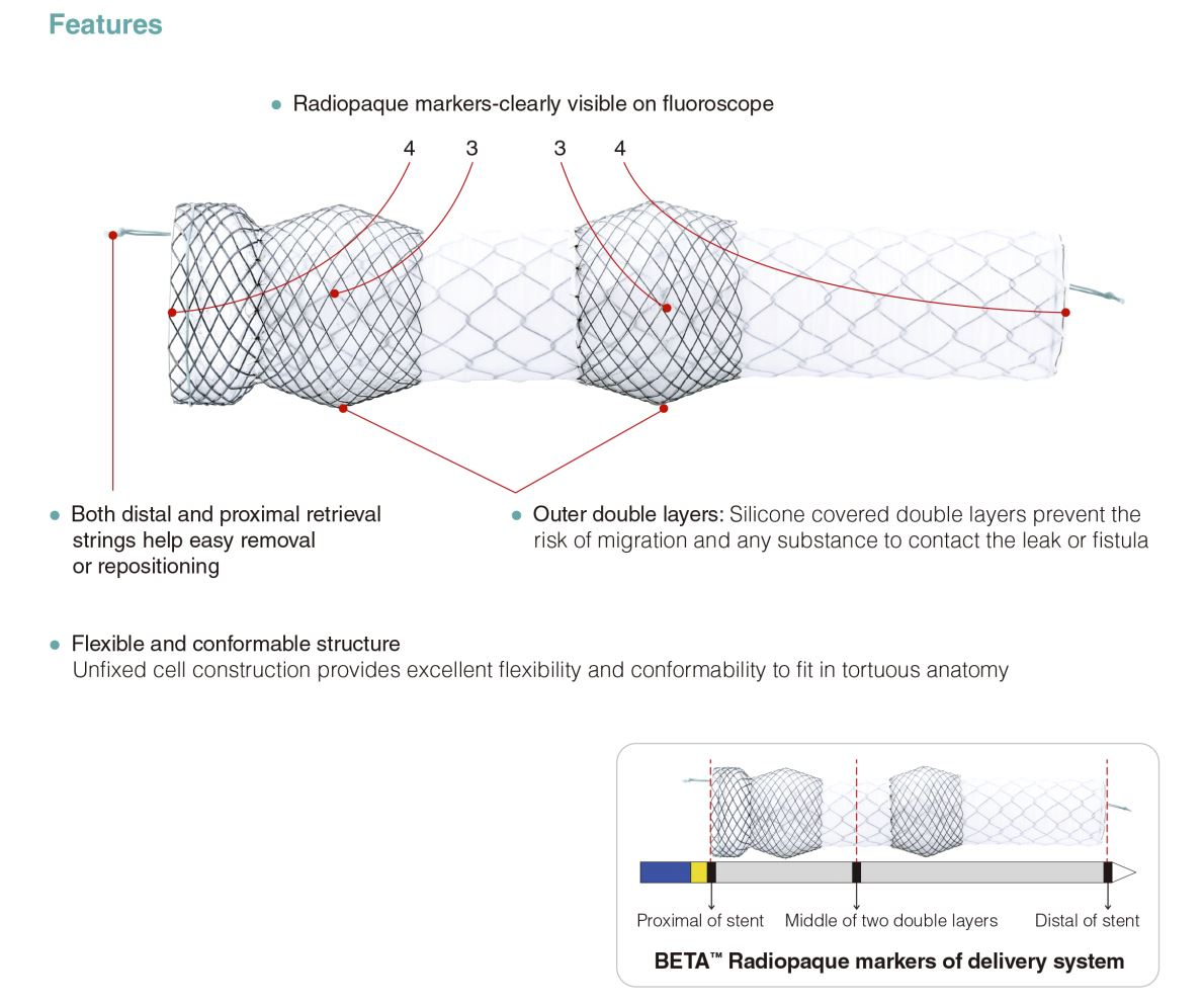 Niti-S™ BETA™ Esophageal Stent - features