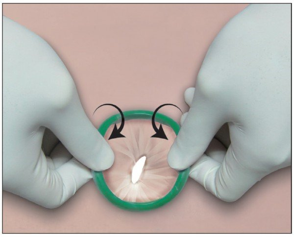 LapShield™ Wound Retractor 2