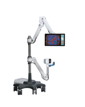 Dysis Smart Colposcopy