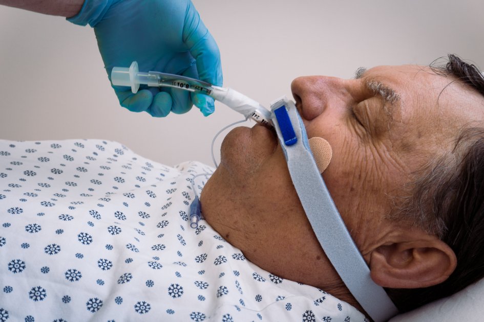 Dispositif de fixation pour sonde d’intubation | Duomed